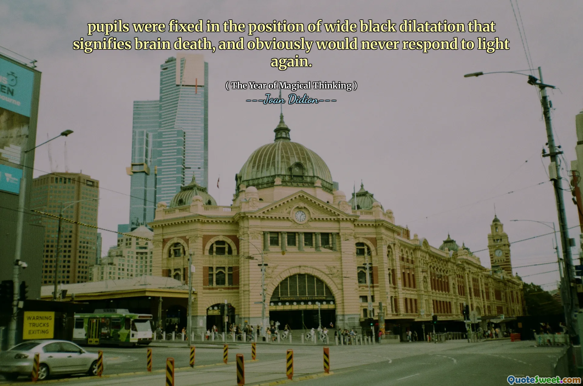 Die Schüler wurden in der Position einer breiten schwarzen Dilatation fixiert, die den Tod des Gehirns bedeutet und offensichtlich nie wieder auf Licht reagieren würde.